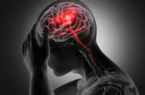 Brain Injury from a Personal Injury Accident